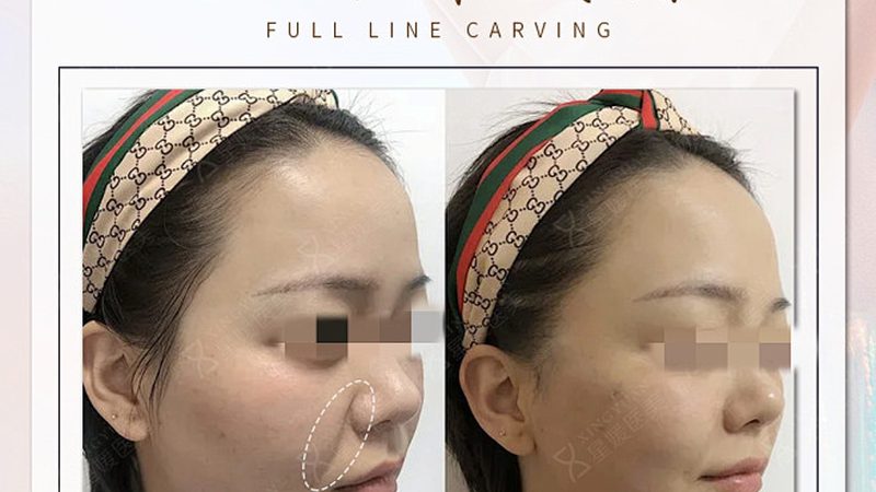 敏感肌的呵护之道：管理步骤与产品搭配指南