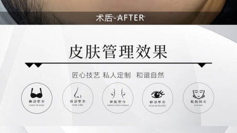 超声炮去眼袋效果显著，了解频率是关键**