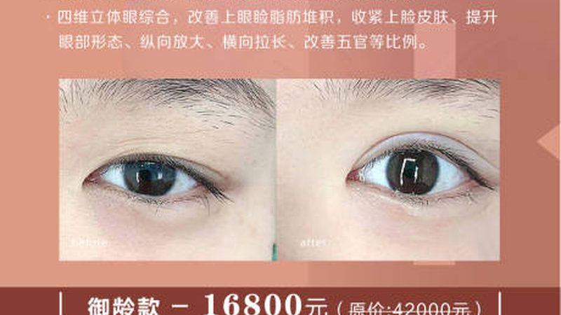 激光祛斑与光子嫩肤：揭秘两者差异，助你美丽无忧