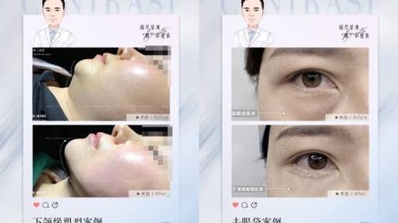 水光针家用与医美区别
