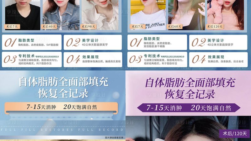 年轻人选择注射美容，这些因素你必须知道