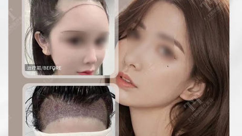 医美咨询师面试常见问题解析