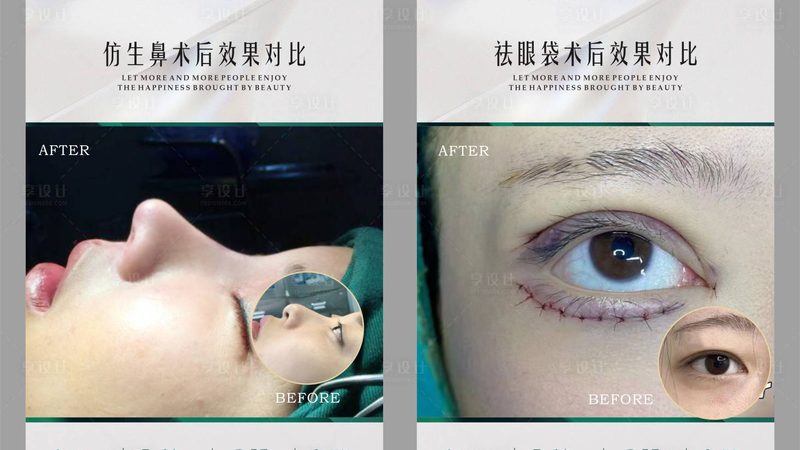 国产水光针与玻尿酸，究竟有何区别？**