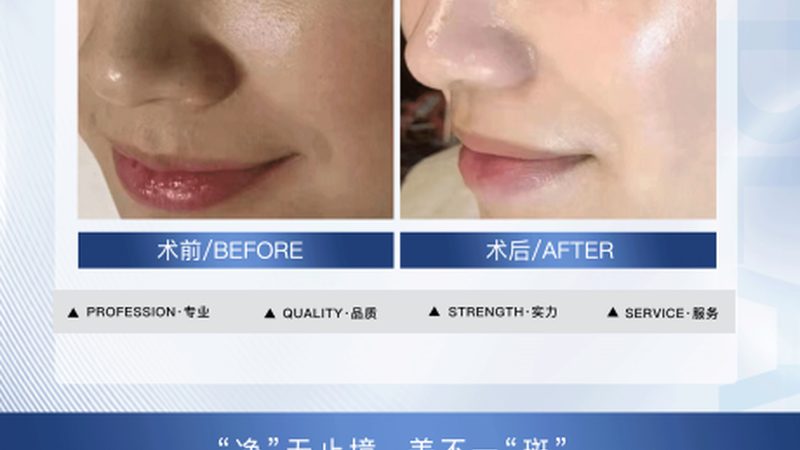 热玛吉官方授权机构查询，揭秘如何甄别真伪