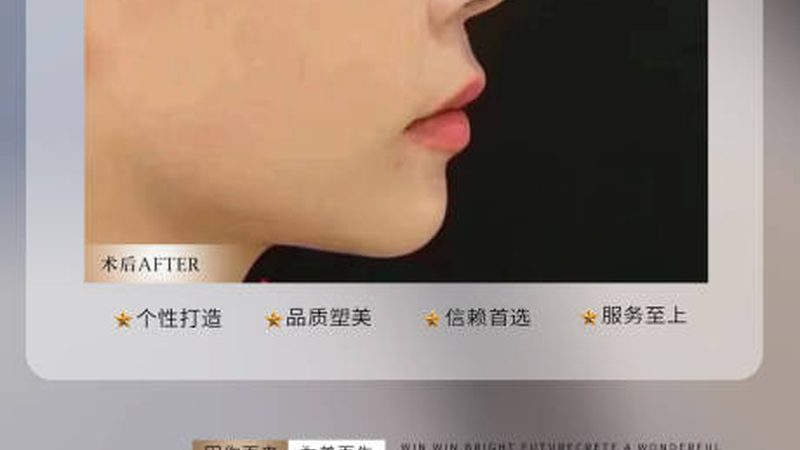 光子嫩肤适合各个年龄段的求美者，尤其是以下几类人群：