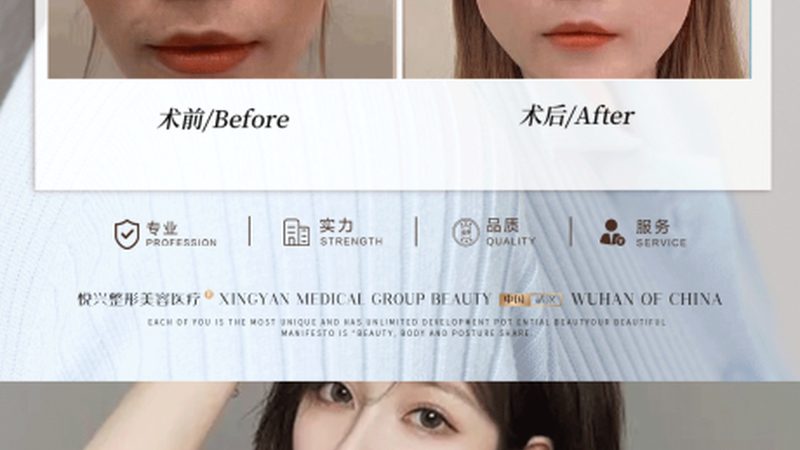 家用光子嫩肤仪适用于以下人群：