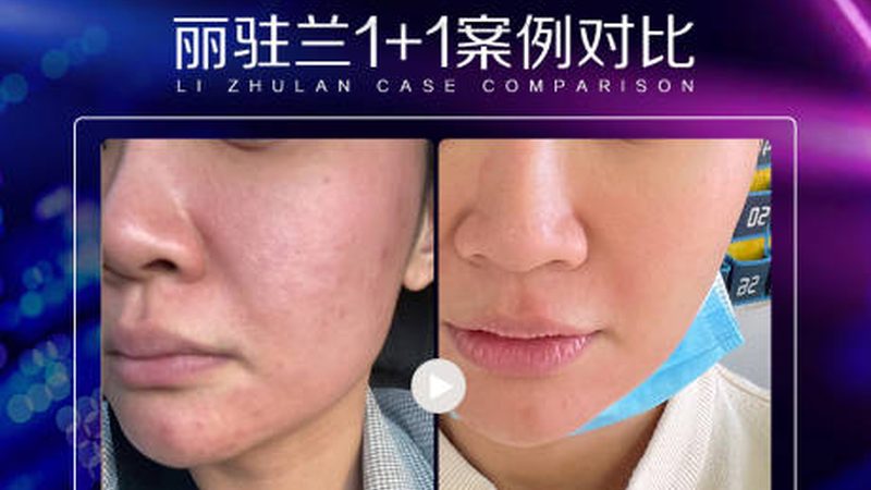 成都割双眼皮医生资质查询