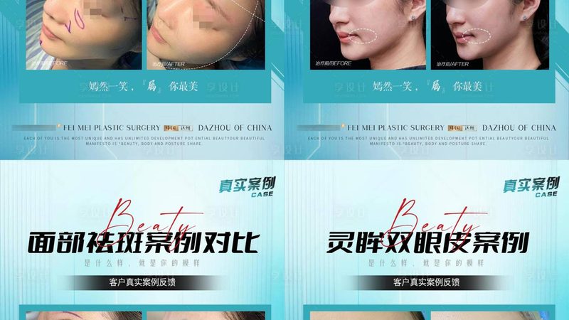 医美咨询师，揭秘她们背后的专业素养