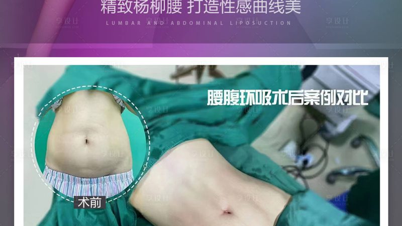 上海打瘦脸针，揭秘适合哪些人群
