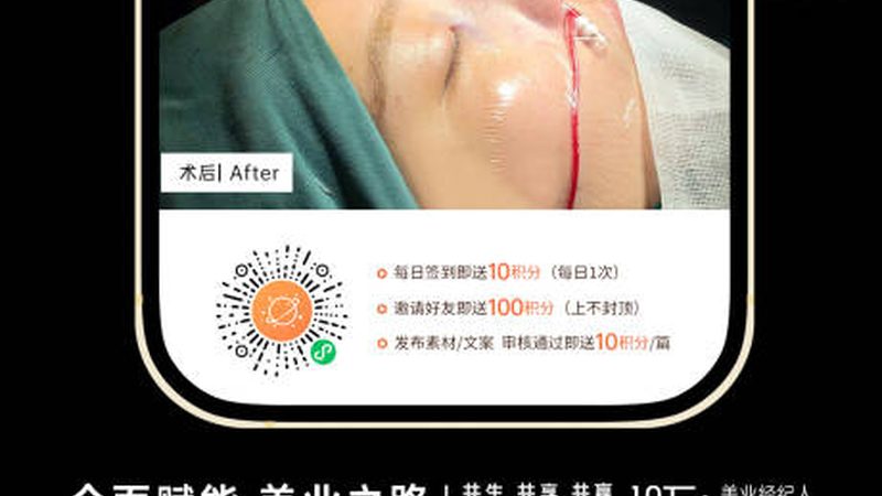 上海隆鼻失败案例多吗？揭秘隆鼻手术的风险与规避