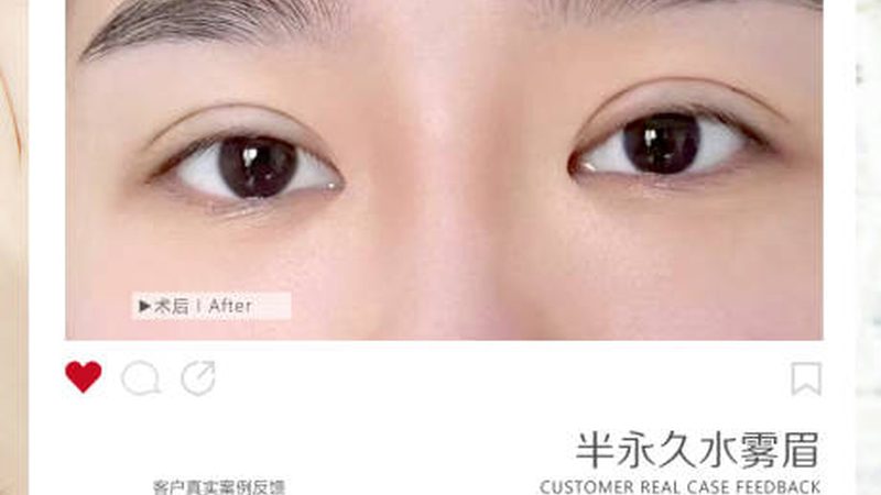 超声炮仪器安装流程，揭秘医美设备操作步骤
