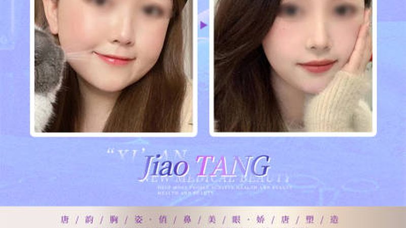 埋线提升失败？揭秘修复方法及注意事项**
