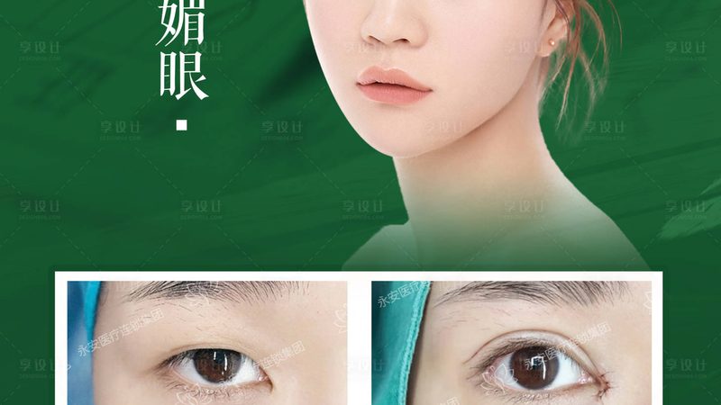 热玛吉VS线雕：揭秘两种医美项目的自然效果差异