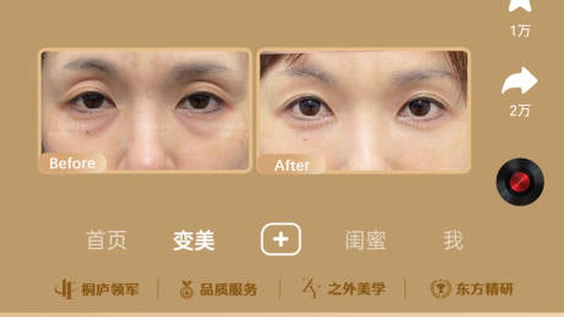 美容院光子嫩肤仪器操作流程全解析