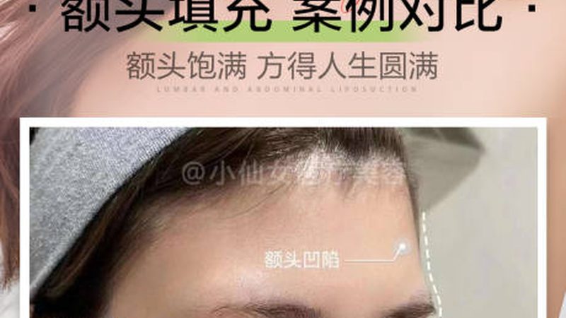 术后初期：注意保湿与防晒